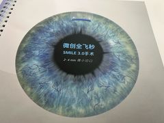-成都新视界眼科医院·近视手术·儿童近视