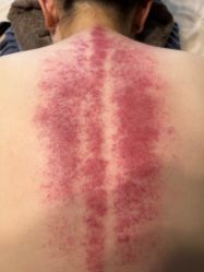 -美悦妈妈产后修复中心