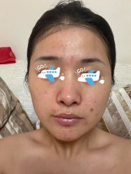-新美荟医美·专注面部美学抗衰