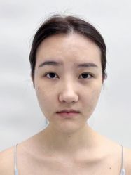 点击看大图 体验前-深圳艺星医疗美容医院