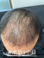 -雍禾植发全国连锁