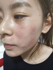 -北京美痣堂古方祛痣斑疣瘊