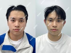 -杭州米兰柏羽医疗美容医院