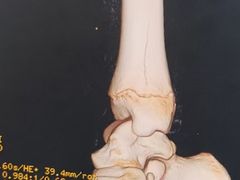 -极限PLAY运动娱乐新世界·团建派对潮玩休闲馆·室内蹦极高空游乐园