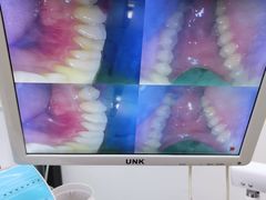 -诺贝尔一诺口腔医院(雁塔院区)