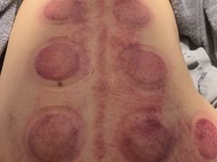 -承启堂中医馆·推拿·针灸(成华馆)