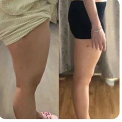 -Lily纤美·科技减脂中心