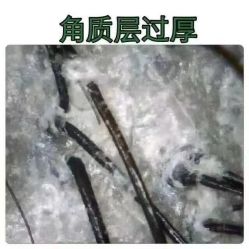 -曼都发型