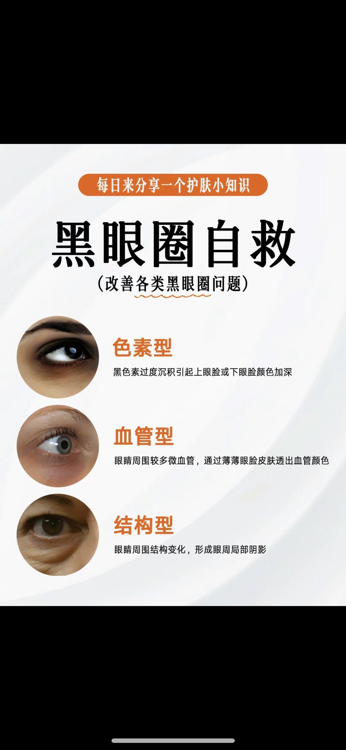 黑眼圈的形成原因