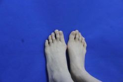 -圣嘉新医疗美容医院