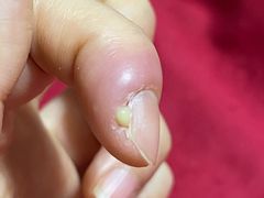 -新甲连锁灰指甲·甲沟炎·鸡眼(黑龙江路店)