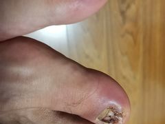 -足护氏采耳修脚(七克拉店)