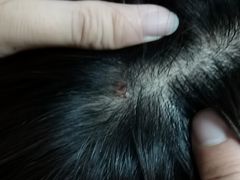 -北京中医药大学第三附属医院