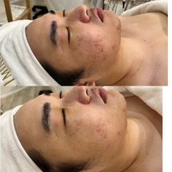 -LUNA皮相美·骨相美高级美感