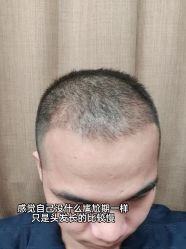 -雍禾植发全国连锁