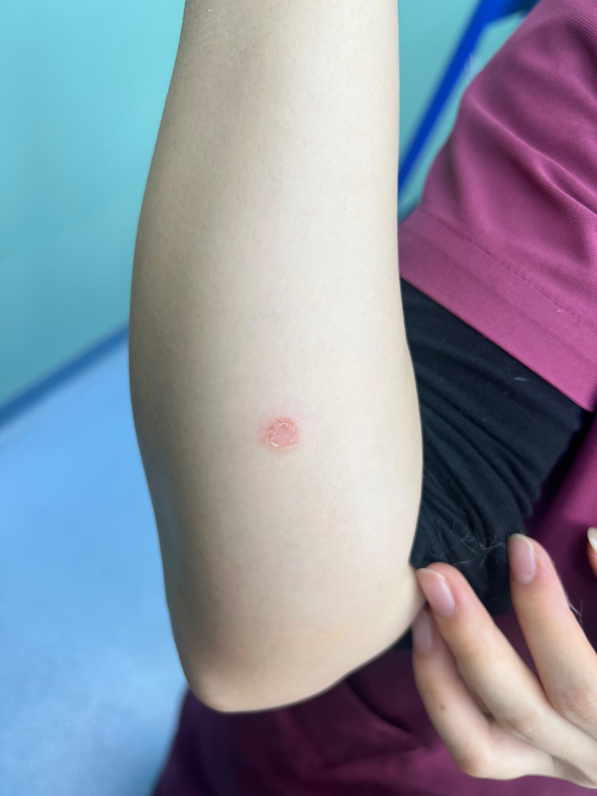 小猫为什么会得猫癣呢为什么在线 小猫为什么会得猫癣呢为什么在线