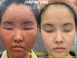 -元熙兰积皮肤管理