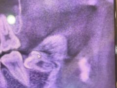 -土豆口腔(凤凰北总店)