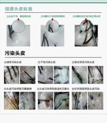 -希梵尔头皮抗衰·科技养发