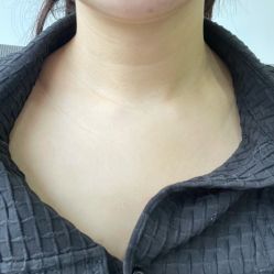 体验后-天河爱来医疗美容门诊部
