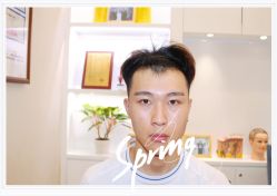 点击看大图 体验后-大麦微针植发全国连锁