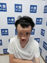点击看大图 -大麦微针植发丨全国连锁