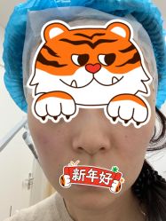 体验前-天津伊美尔医疗整形美容专科医院