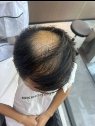 -唐风采假发补发定制