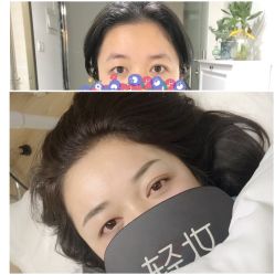 -Doris多里斯半永久纹眉·SMP纹发·发际线