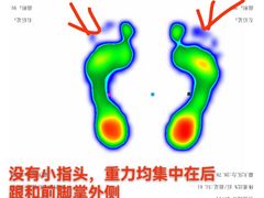-Andrew指甲专科灰指甲·甲沟炎矫正·3D步态矫形鞋垫定制(上海法华镇路旗舰店)