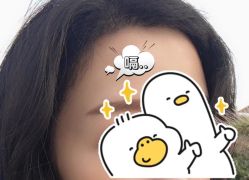 -大麦微针植发全国连锁