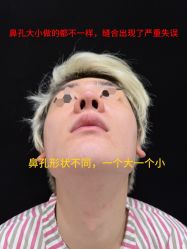 -北京米扬丽格医疗美容·联合丽格鼻整形中心