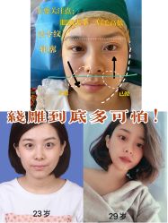 -广州美莱医疗美容医院