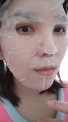 体验后-新美荟医美·专注面部美学抗衰