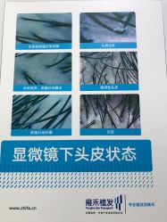 点击看大图 -雍禾植发全国连锁