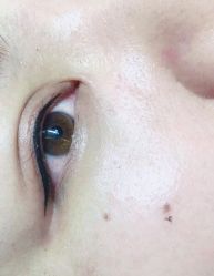 -莲姿娜·半永久纹眉皮肤管理