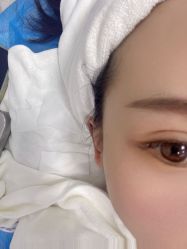 -蕾特恩专业祛痘国际连锁
