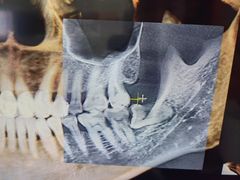 -同步齿科·数字化正畸种植口腔中心(珠海店)