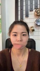 -天津健丽·去眼袋医疗美容机构