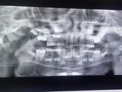 -土豆口腔(凤凰北总店)