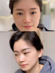 -Doris多里斯半永久纹眉·SMP纹发·发际线
