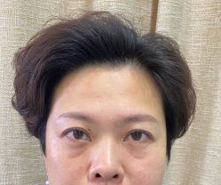 点击看大图 体验前-重庆联合丽格第五医疗美容医院