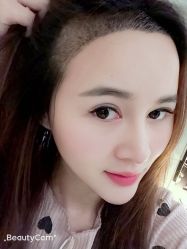 -大麦微针植发丨全国连锁