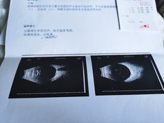 -东北大学附属辽宁爱尔眼科医院