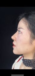 体验后-杭州美莱医疗美容医院