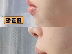 -极光口腔·矫正种植修复(锦江店)