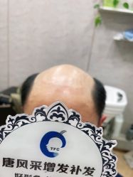 -唐风采假发补发定制
