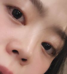 -青青一生美皮肤管理