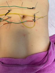 -清媚减肥瘦身纤体