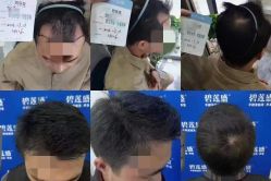 点击看大图 -碧莲盛·脱发养发中心